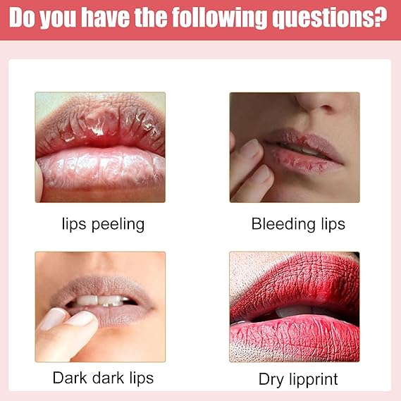 Lip whitening cream moisturizing and pinkish look