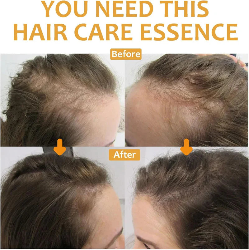 OHO - Biotin Hair Growth Serum